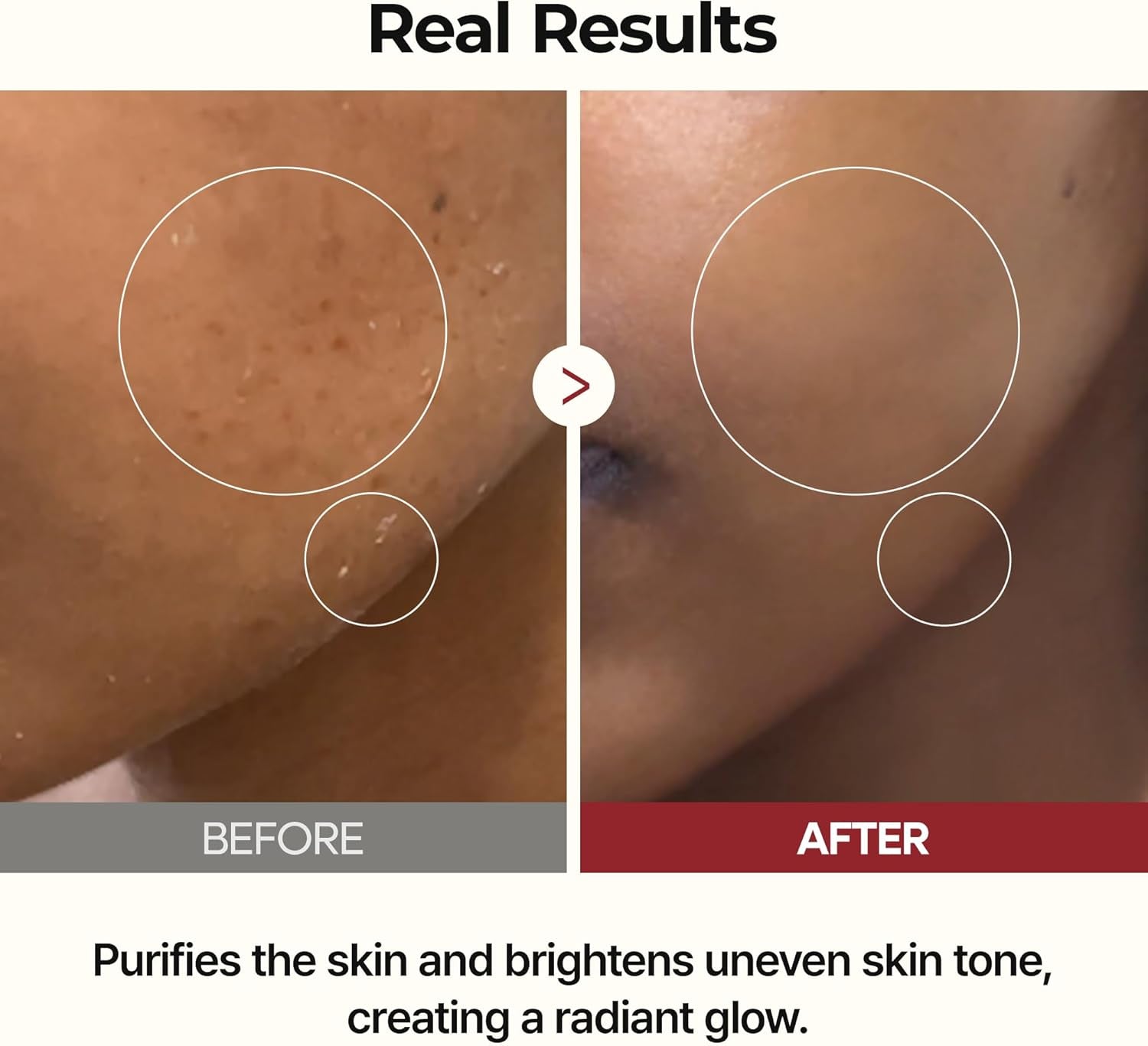 Peel Shot Glow Rice Toner 200Ml Hydrated Skin Cleansing Skin Korean Skin Care